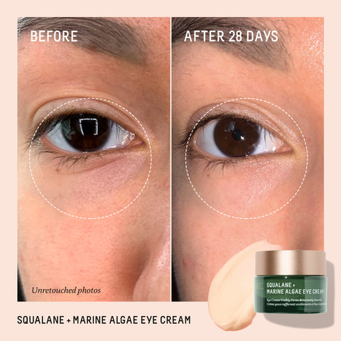Before and After of customer using Marine Algae Eye Cream with bright skin and reduced appearance of wrinkles