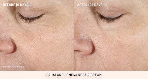 Omega Repair Cream Before and After