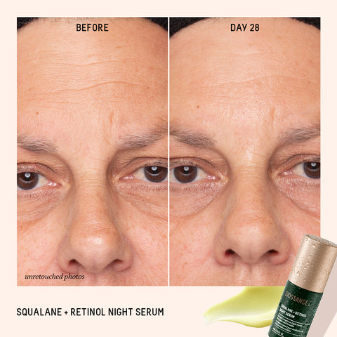 Retinol Before and After