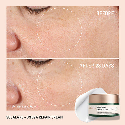 Before and After image of positive results in plumping fine lines with Omega Repair Cream