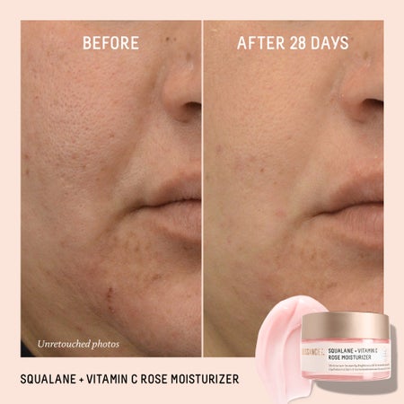 Squalane + Vitamin C Rose Moisturizer Image 4