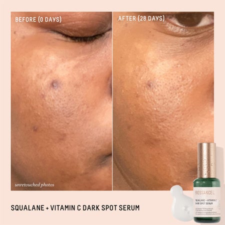 Squalane + Vitamin C Dark Spot Serum Image 3