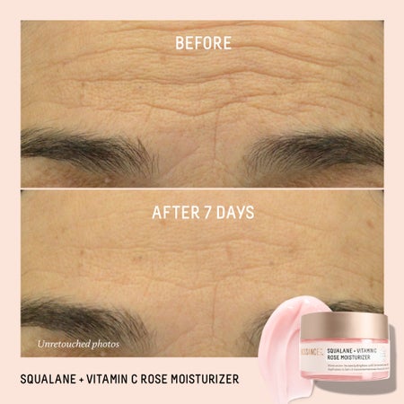 Squalane + Vitamin C Rose Moisturizer Image 3